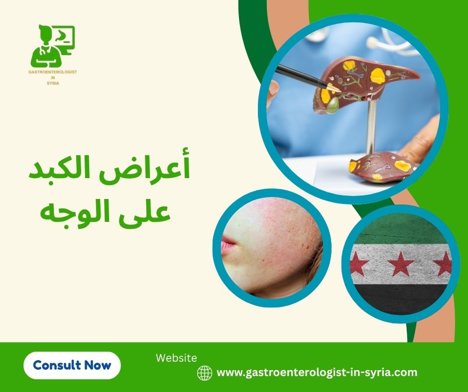أعراض الكبد على الوجه