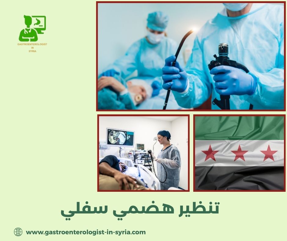 تنظير هضمي سفلي