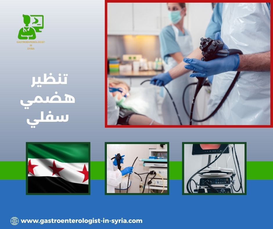 التنظير السفلي