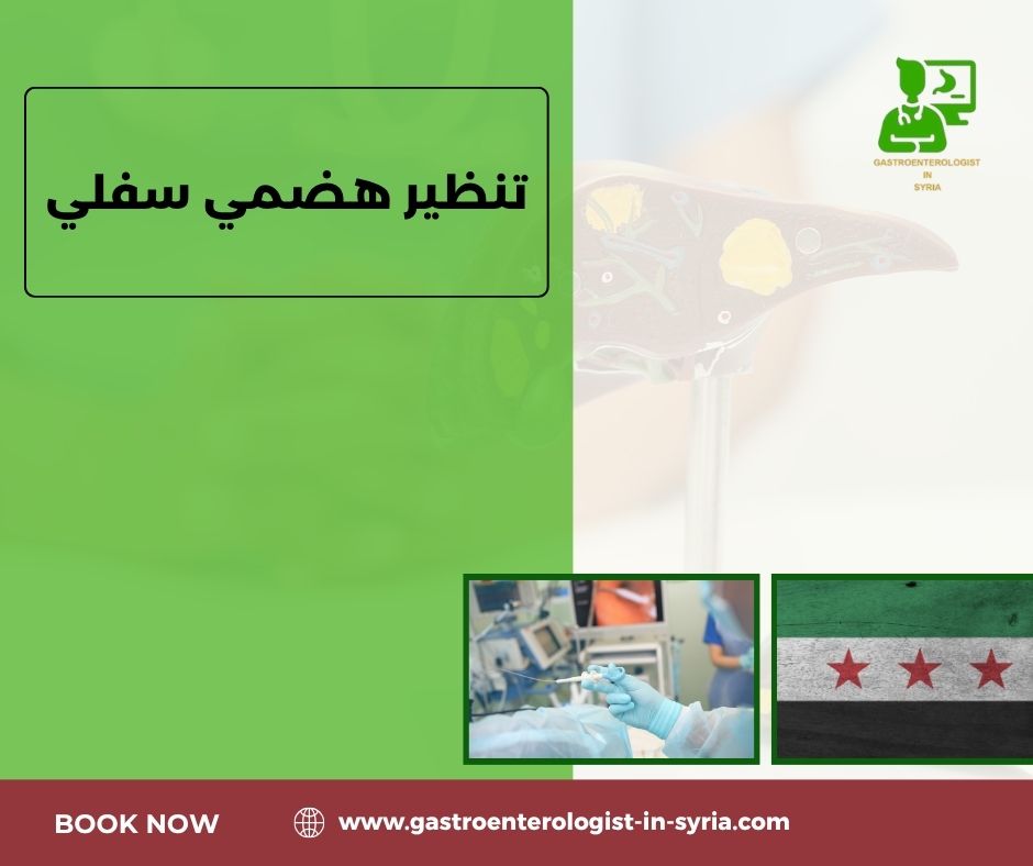 تنظير هضمي سفلي
