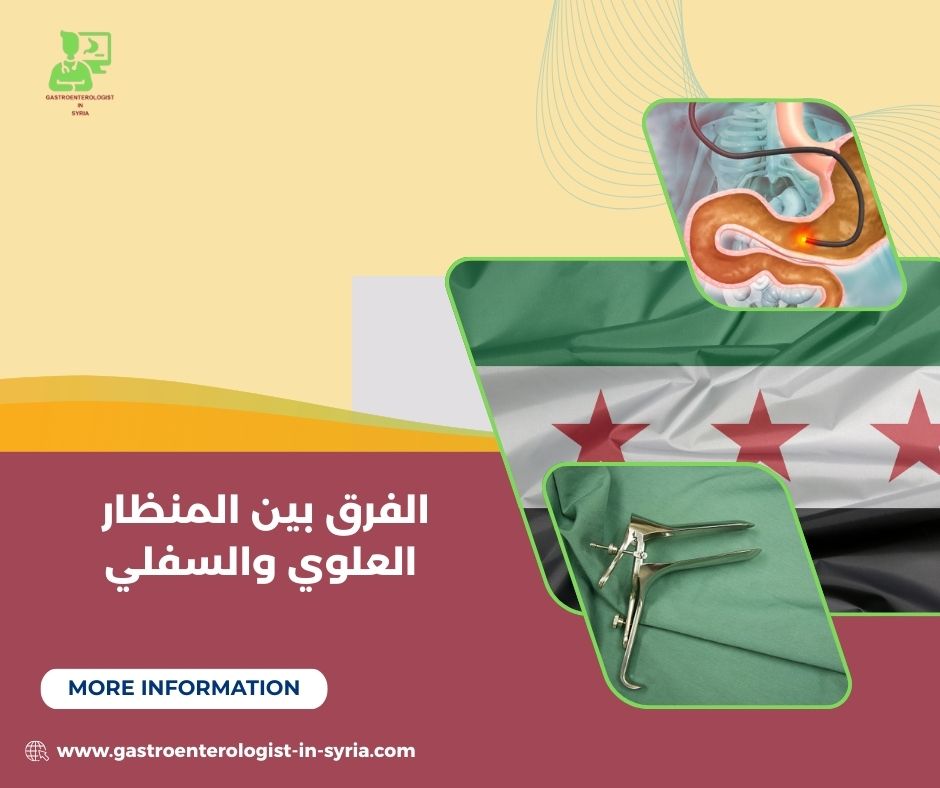 تكلفة المنظار العلوي والسفلي في سوريا