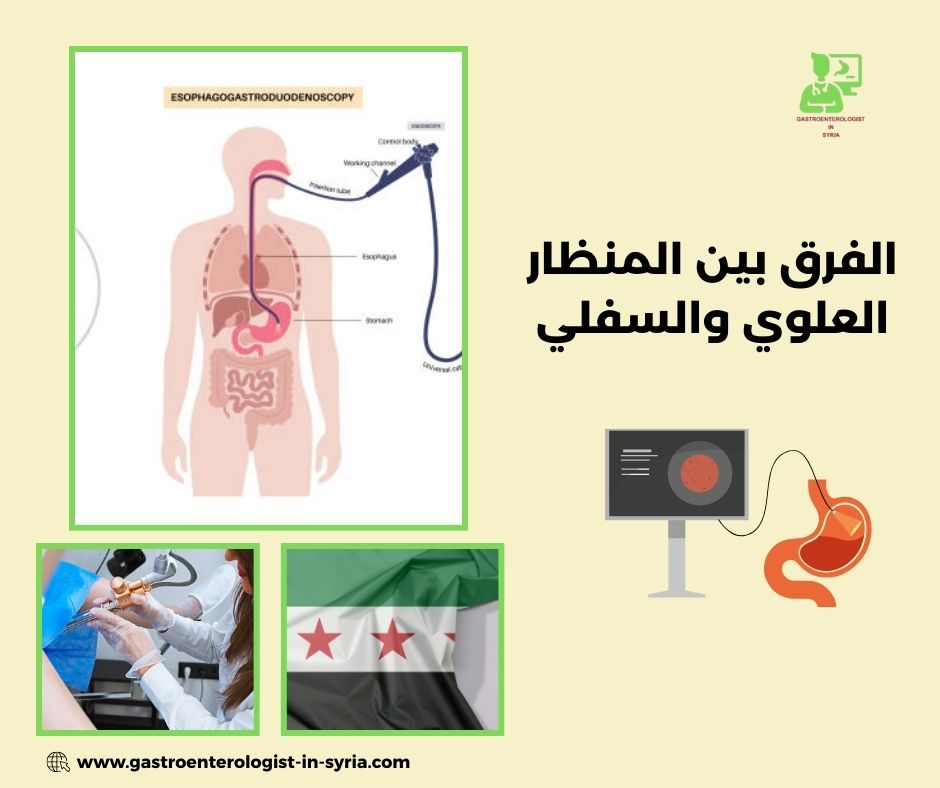 الفرق بين المنظار العلوي والسفلي