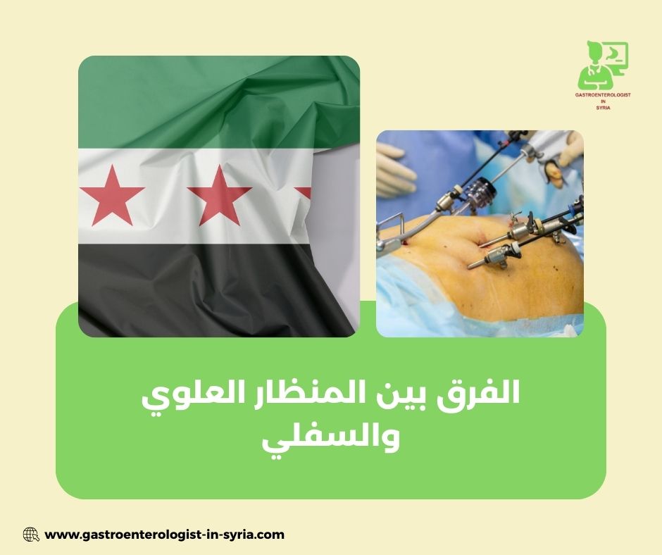 أسئلة شائعة حول تكلفة المنظار في سوريا