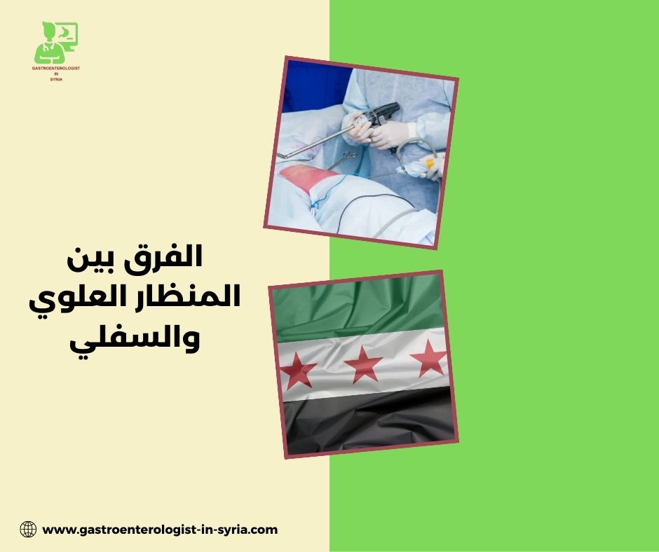 العوامل التي تتحكم بسعر المنظار في سوريا