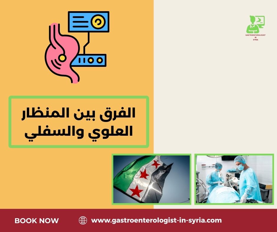 تكلفة المنظار السفلي في سوريا