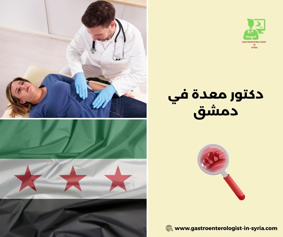 أسئلة شائعة حول دكتور معدة في دمشق