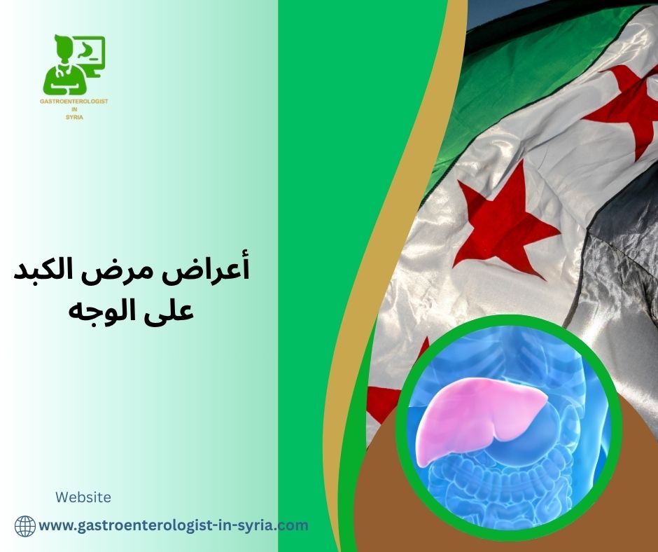 أعراض مرض الكبد على الوجه أعراض مرض الكبد على الوجه