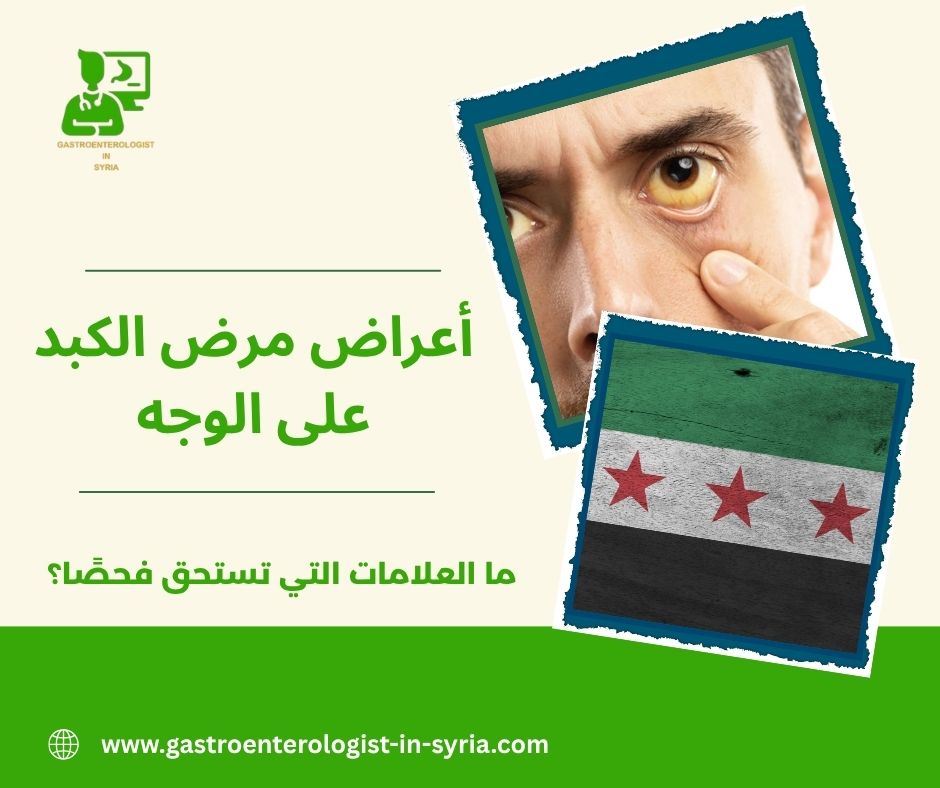 أعراض مرض الكبد على الوجه