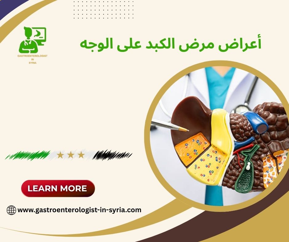 أعراض مرض الكبد على الوجه أعراض مرض الكبد على الوجه