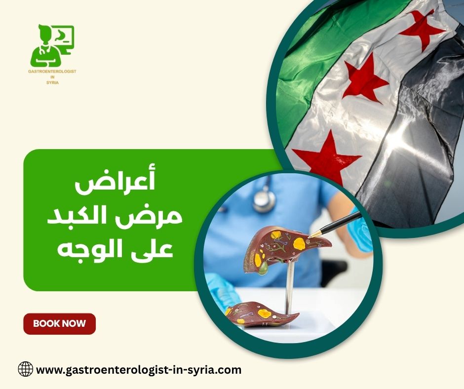 أعراض مرض الكبد على الوجه أعراض مرض الكبد على الوجه