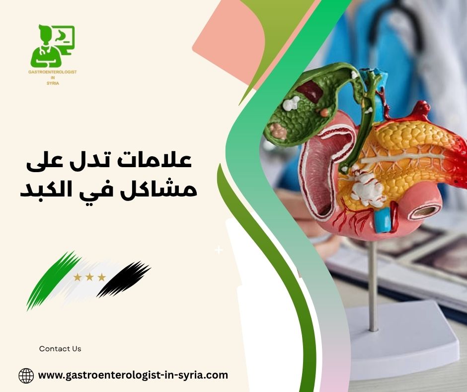 علامات تدل على مشاكل في الكبد علامات تدل على مشاكل في الكبد