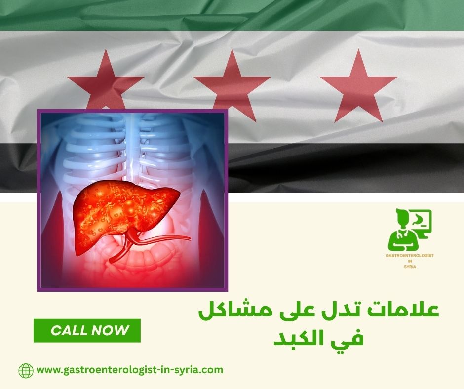 علامات تدل على مشاكل في الكبد علامات تدل على مشاكل في الكبد
